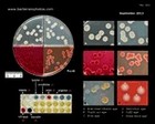 klebsiella pneumoniae biochemical tests